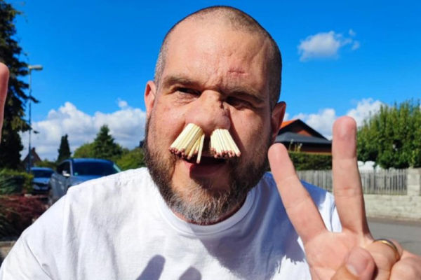 Swedish man shoves 81 matches up his nose, earns world record